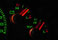 US Speedo Stainless Steel Gauge Face Kit